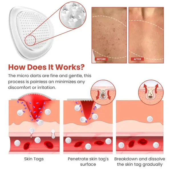 DERMA SMOOTH TAG REMOVER PATCH